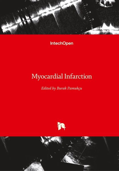 Myocardial Infarction
