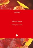 Liver Cancer Liver Cancer
