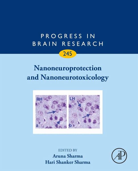 Nanoneuroprotection and Nanoneurotoxicology (eBook, ePUB) Nanoneuroprotection and Nanoneurotoxicology (eBook, ePUB)