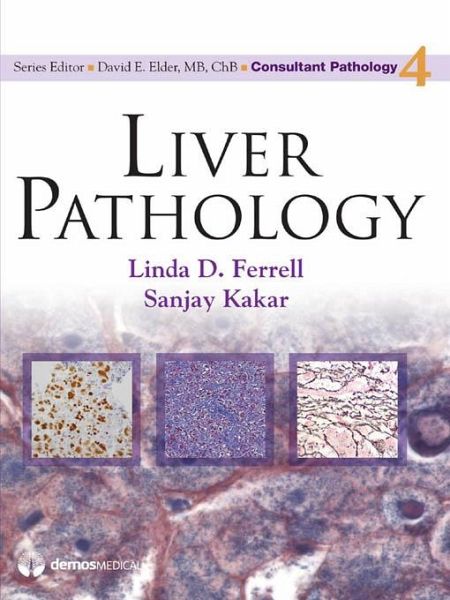 Liver Pathology (eBook, ePUB) Liver Pathology (eBook, ePUB)