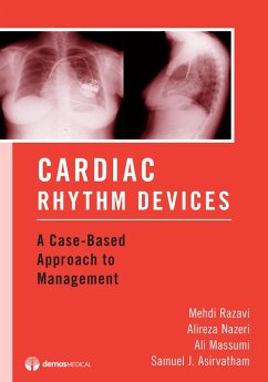 Cover Cardiac Rhythm Devices (eBook, ePUB)
