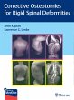Rigid Spine Deformities - Bild 1