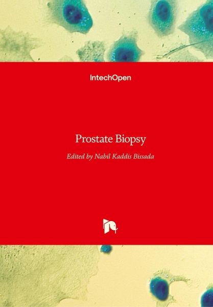 Prostate Biopsy
