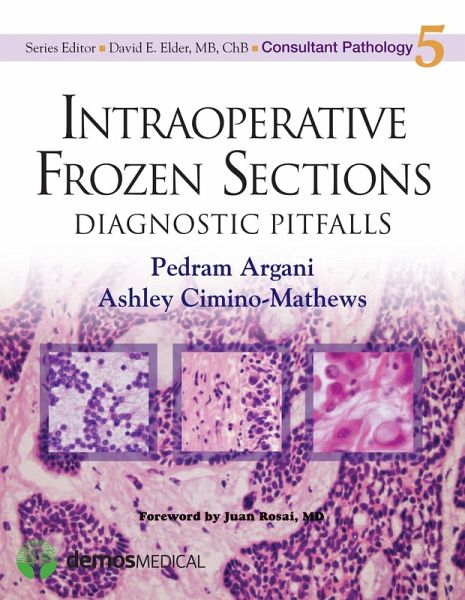 Intraoperative Frozen Sections (eBook, ePUB)