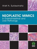 Neoplastic Mimics in Gastrointestinal and Liver Pathology (eBook, ePUB)