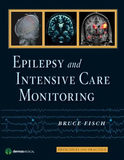 Epilepsy and Intensive Care Monitoring (eBook, ePUB) - Fisch, Bruce
