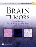 Brain Tumors (eBook, ePUB) Brain Tumors (eBook, ePUB)