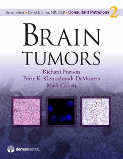 Cover Brain Tumors (eBook, ePUB)