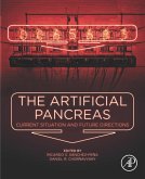 The Artificial Pancreas (eBook, ePUB)