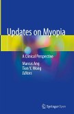 Updates on Myopia