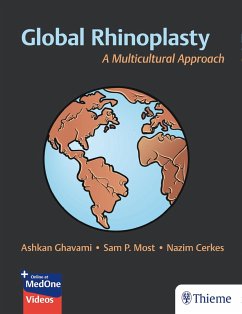 Global Rhinoplasty - Ghavami, Ashkan;Most, Sam;Cerkes, Nazim