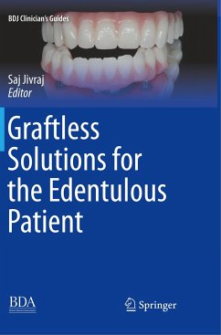 Graftless Solutions for the Edentulous Patient