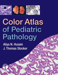 Color Atlas of Pediatric Pathology (eBook, ePUB)