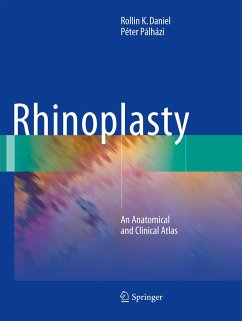 Rhinoplasty - Daniel, Rollin K.;Pálházi, Péter