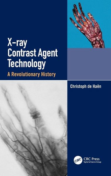 X-ray Contrast Agent Technology X-ray Contrast Agent Technology
