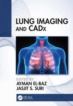Cover Lung Imaging and CADx (eBook, ePUB)