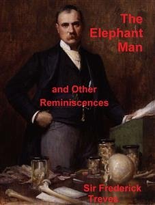 The Elephant Man and Other Reminiscences (eBook, ePUB) - Frederick Treves, Sir