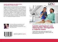 Lesión periapical con obturación retrógrada e injerto óseo - Jarrín Peñafiel, María José;Castro, Jaime;Toscano, Vicente