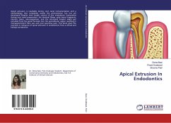 Apical Extrusion In Endodontics
