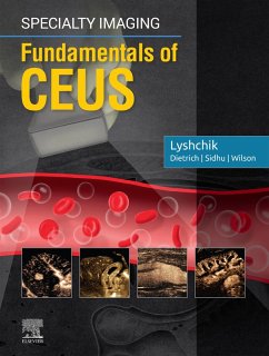 Cover Specialty Imaging: Fundamentals of CEUS E-Book (eBook, ePUB)