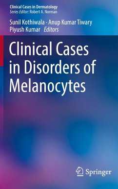 Clinical Cases in Disorders of Melanocytes