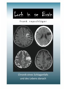 Loch in se Brain (eBook, ePUB)