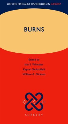 Cover Burns (eBook, ePUB)