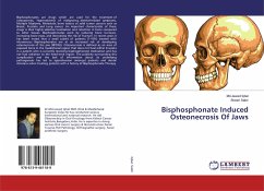 Bisphosphonate Induced Osteonecrosis Of Jaws - Iqbal, Md.Jawed;Sabir, Sheeri