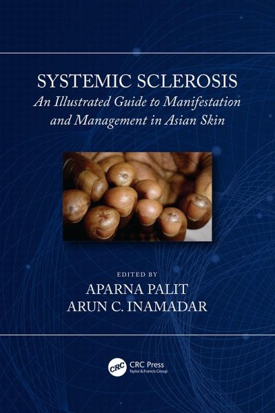 Systemic Sclerosis (eBook, PDF) Systemic Sclerosis (eBook, PDF)