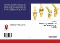 Arthroscopic Repair Of Torn Meniscus By Fast-Fix