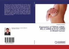 Expression of TOP2A mRNA, BCL-2 mRNA & KI-67 mRNA in Breast Cancer