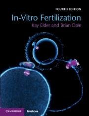In-Vitro Fertilization - Elder, Kay (Bourn Hall Clinic, Cambridge); Dale, Brian
