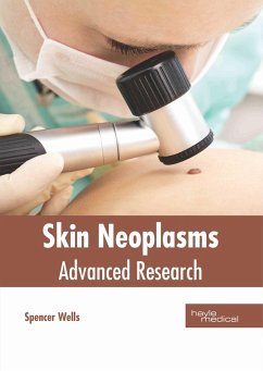 Skin Neoplasms: Advanced Research