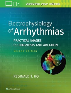 Electrophysiology of Arrhythmias - Ho, Reginald T. Electrophysiology of Arrhythmias - Ho, Reginald T.
