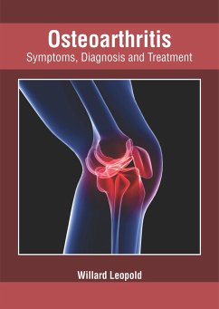 Osteoarthritis: Symptoms, Diagnosis and Treatment