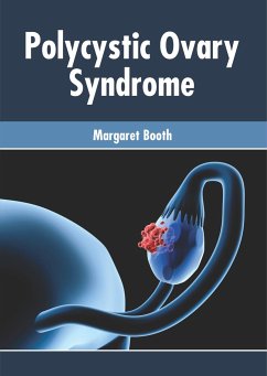 Polycystic Ovary Syndrome