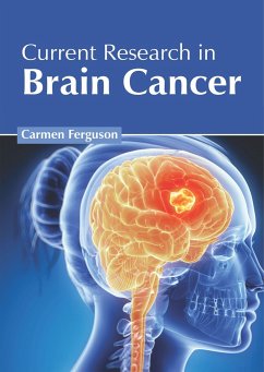 Current Research in Brain Cancer