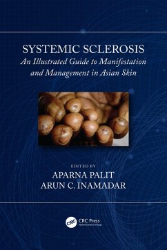 Cover Systemic Sclerosis (eBook, ePUB)