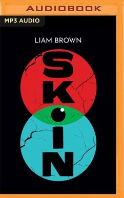 Skin - Brown, Liam