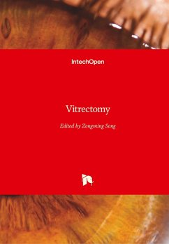 Cover Vitrectomy