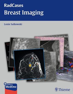 Radcases Breast Imaging (eBook, PDF) - Salkowski, Lonie L.