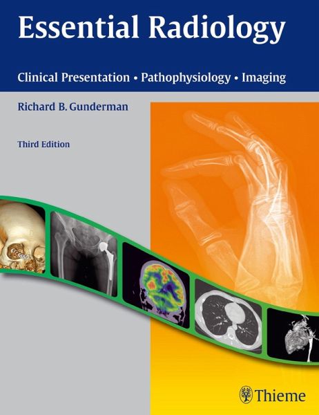 Essential Radiology (eBook, PDF) Essential Radiology (eBook, PDF)