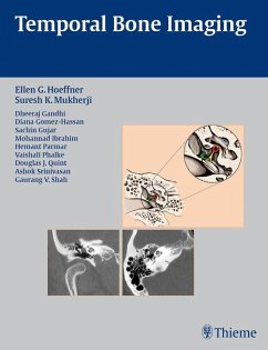 Temporal Bone Imaging (eBook, ePUB)