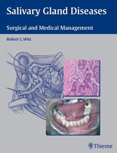 Cover Salivary Gland Diseases (eBook, PDF)