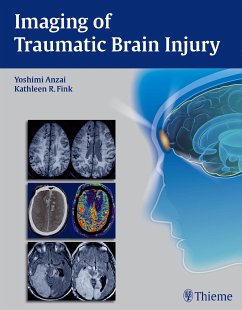 Imaging of Traumatic Brain Injury (eBook, PDF)