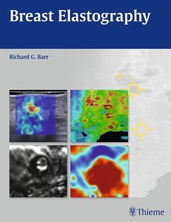 Cover Breast Elastography (eBook, PDF)