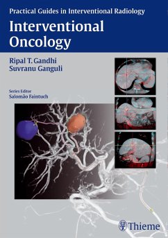 Cover Interventional Oncology (eBook, PDF)