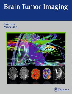 Brain Tumor Imaging (eBook, PDF) - Jain, Rajan; Essig, Marco