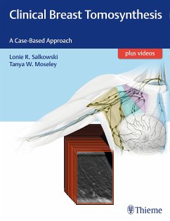 Clinical Breast Tomosynthesis (eBook, PDF) - Salkowski, Lonie R.; Moseley, Tanya