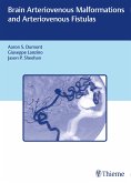 Brain Arteriovenous Malformations and Arteriovenous Fistulas (eBook, PDF)